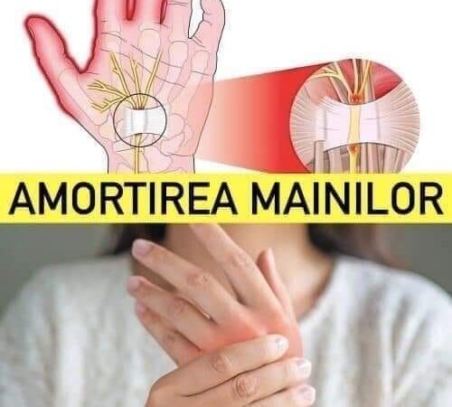 Amorțirea mâinilor  un semnal important că trebuie să mergeți la medic. 5 cauze posibile