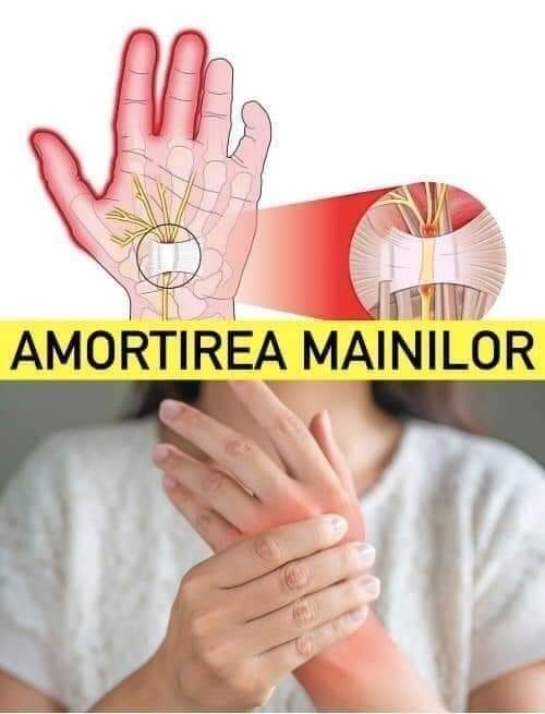 Amorțirea mâinilor  un semnal important că trebuie să mergeți la medic. 5 cauze posibile