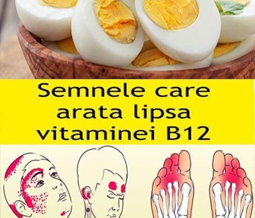 Lipsa VITAMINEI B12 Provoaca Probleme Grave De Sanatate. Cum Poti Sa O Recunosti Si Ce Trebuie Sa Faci