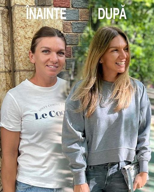 Simona Halep primele imagini după cele două intervenții suferite la nas. Cum s-a postat jucătoarea de tenis la scurt timp de la operație  FOTO