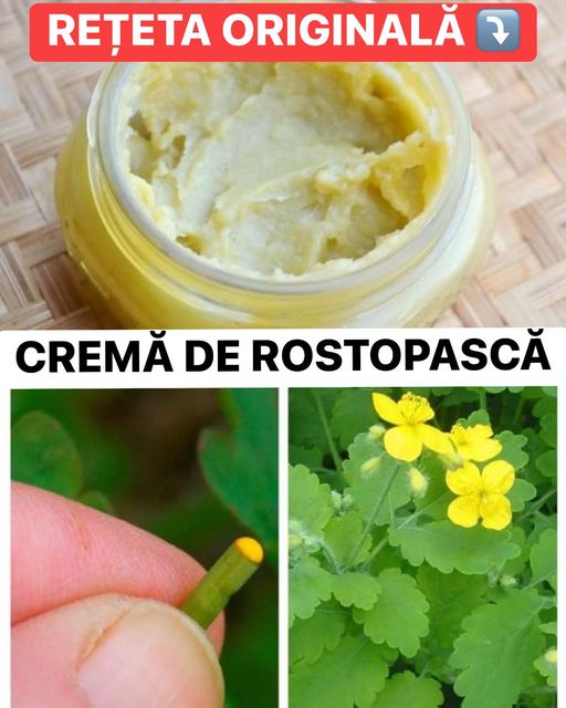 Crema de Rostopască  unul dintre cele mai eficiente unguente împotriva psoriazisului și a negilor. Are efecte antispastice analgezice antiseptică antibacteriană regenerantă cicatrizantă și antitumorală