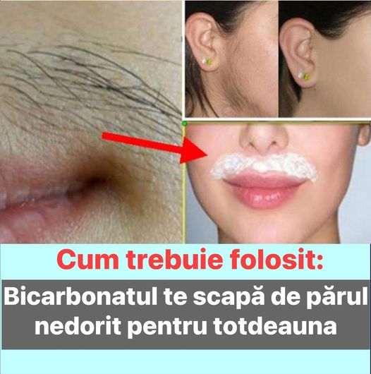 Bicarbonatul te scapă de părul nedorit pentru totdeauna  Cum trebuie folosit