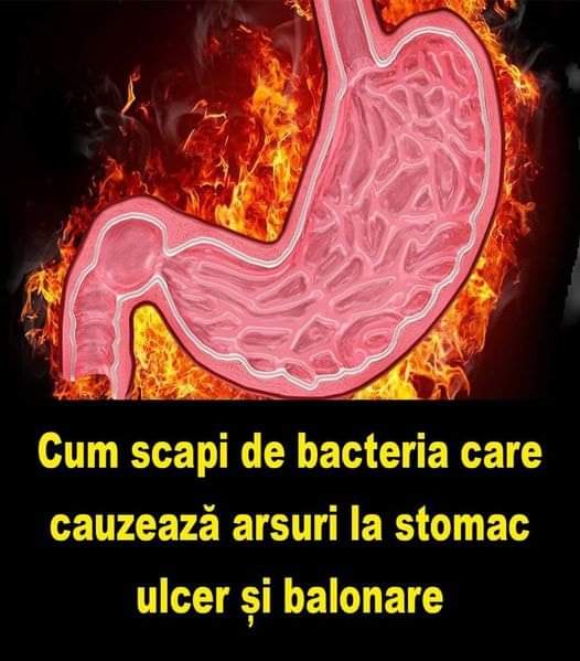 NU IGNORA Cum scapi de bacteria care cauzează arsuri la stomac ulcer și balonare Trebuie sa stii asta